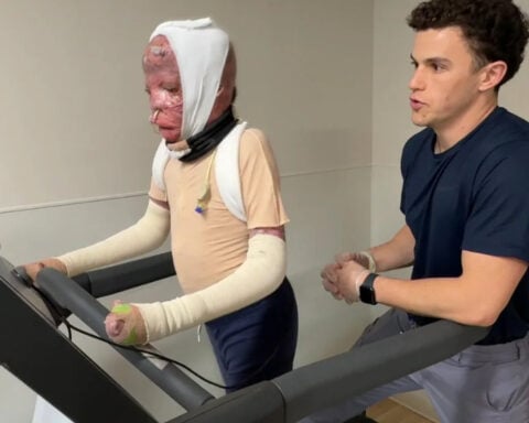 1 year after deadly Northeast Philadelphia plane crash, inside 10-year-old Ramesses' road to recovery