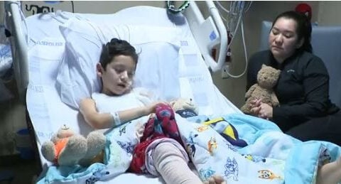 Boy recovering after sparkler accident that caused severe burns