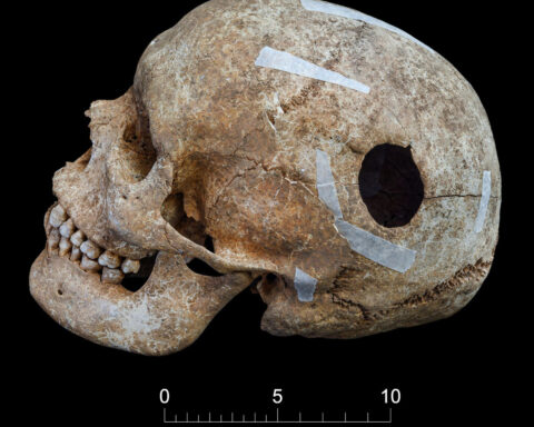 Skeletons found in mysterious pit died violent deaths in Anglo-Saxon-era England