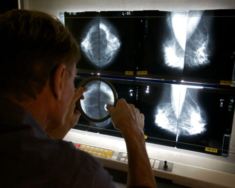 This job has become the ultimate case study for why AI won’t replace human workers