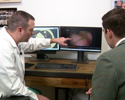 UCHealth using new technology to identify cancer cells previously missed