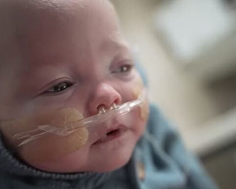 Baby defies odds with miraculous recovery from health challenges