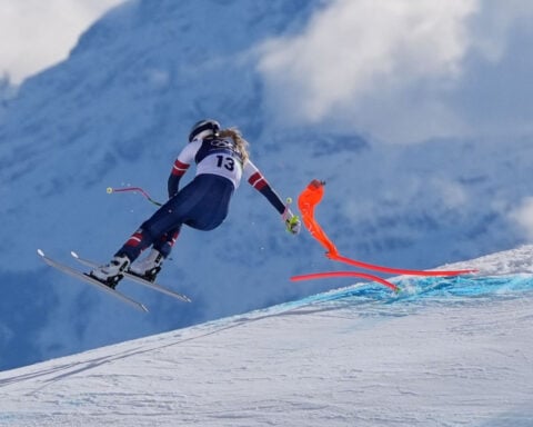 Lindsey Vonn says her doctor saved leg from amputation