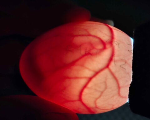 A bumper berry harvest has New Zealand's weird flightless parrot in a rare mood for romance