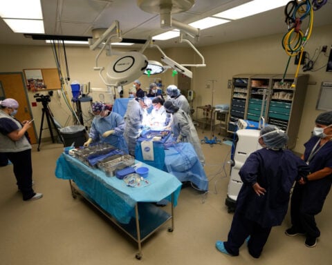 More organs are being donated after the heart stops, not brain death. Policies are changing too