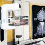 Global breast cancer cases expected to reach over 3.5 million by 2050