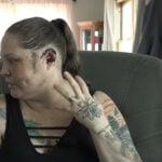 Mountain Home mom recovering after foster dog attack, grateful for community support