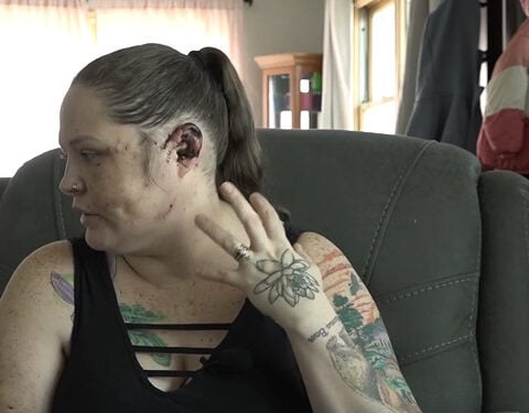 Mountain Home mom recovering after foster dog attack, grateful for community support