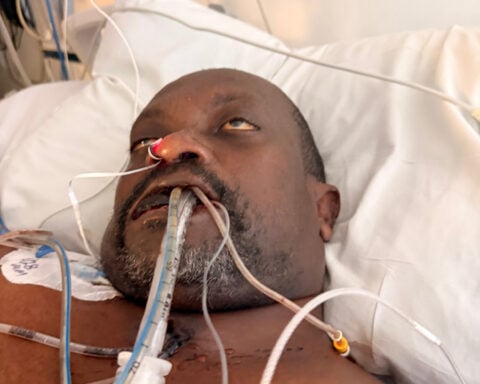 Haitian man dies in US immigration custody with untreated toothache, brother says