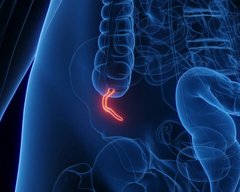 What does the appendix do? Biologists explain the complicated evolution of this inconvenient organ