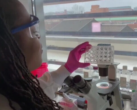 University of Maryland professor grows lab-made fibroids to find better treatments for patients