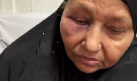 Woman pistol-whipped during robbery while walking to mosque for early morning prayers