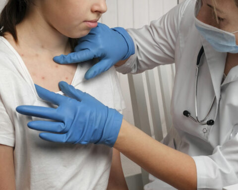 We study pandemics, and the resurgence of measles is a grim sign of what’s coming