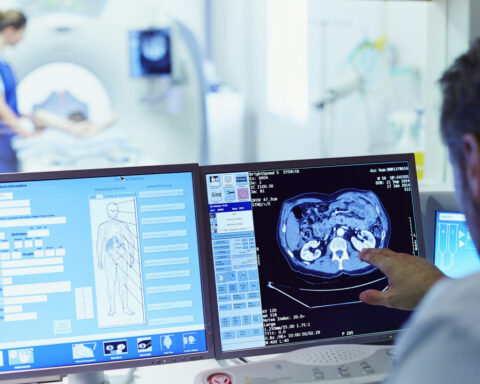 Millions of CT scans are done every year – most leave important data behind