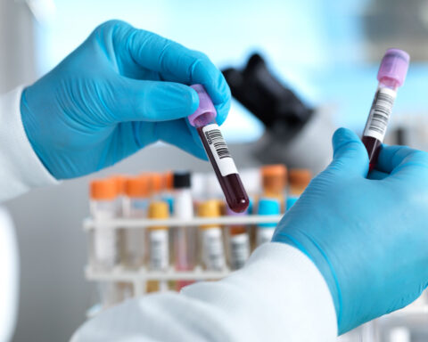Carbon dioxide levels are higher than humans have ever experienced. It could be changing our blood chemistry