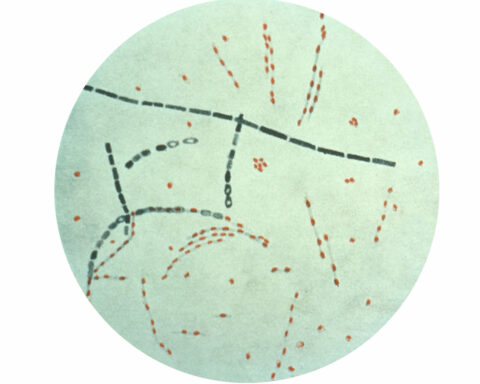 Anthrax-causing bacteria have dwelled in soil for centuries – cycling through people, animals and earth