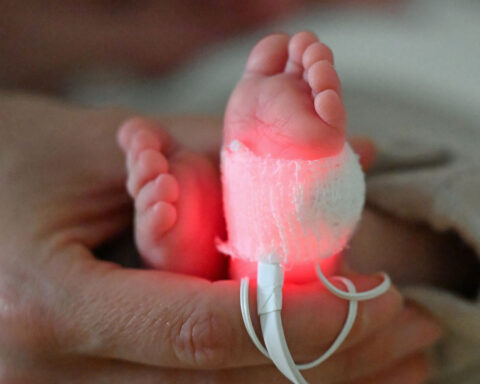 Millions of preterm births and thousands of infant deaths linked to plastic chemical