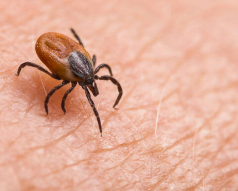 Ticks are the backyard threat southwestern Pennsylvania homeowners keep ignoring