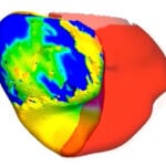 To fix a patient's irregular heartbeat, doctors first tested its digital 'twin'