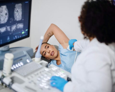 About 80% of breast cancer biopsies turn out benign – new imaging tool promises clearer diagnoses and fewer biopsies