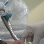 Company develops robot to take guesswork out of dental surgery