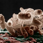 Antibiotics can trigger bacteria to release bubbles of inflammation tinder, making it harder to treat infection