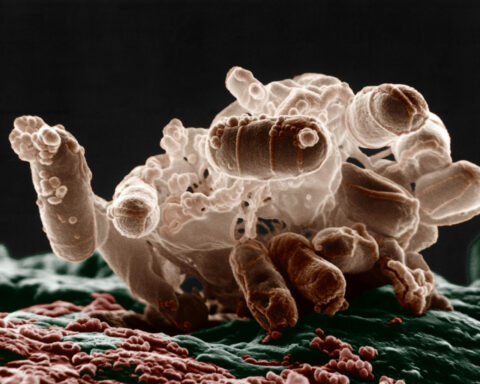 Antibiotics can trigger bacteria to release bubbles of inflammation tinder, making it harder to treat infection