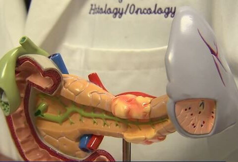 New drug created at Northwestern helps pancreatic cancer patients live longer, oncologist says