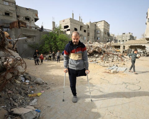 Gaza's war amputees short of prostheses under Israeli restrictions