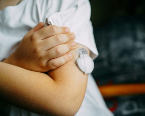 Umbilical cord blood may hold clues for a child’s risk of developing Type 1 diabetes