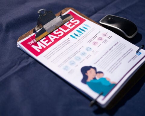 Newer testing methods suggest significant silent spread of measles in the US, threatening elimination
