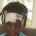 11-year-old boy recounts being hit by a speeding car while walking to school in Miami Gardens