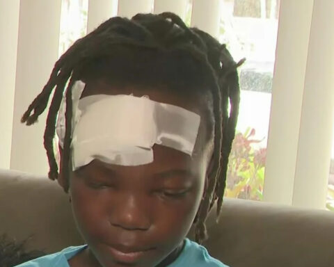 11-year-old boy recounts being hit by a speeding car while walking to school in Miami Gardens
