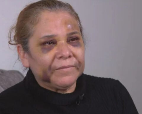 Woman attacked by accused killer of CPD officer shares story of beating at Family Dollar store