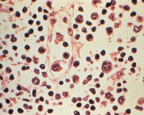 Three cruise ship passengers die in suspected hantavirus outbreak