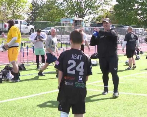 'A chance to be a kid again': Charity helping 11-year-old get new legs