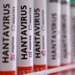 US CDC notifies Texas of two state residents on cruise ship with hantavirus outbreak