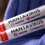 Virginia monitoring traveler linked to Hantavirus-hit cruise ship, says resident is low-risk