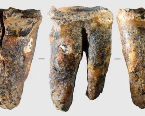 59,000-year-old tooth offers a rare glimpse into how Neanderthals handled a medical problem