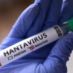 Hantavirus risk to US public remains low, CDC says