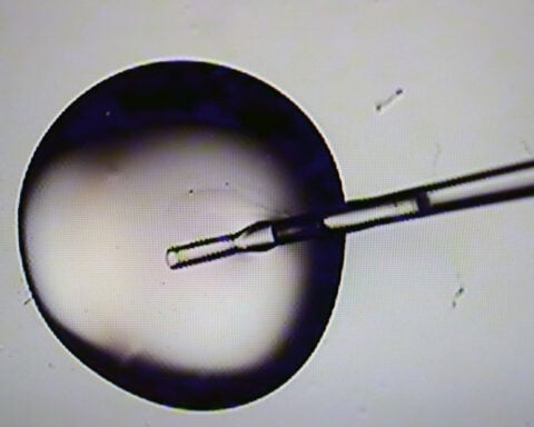 Trump promised no-cost IVF treatment for all. That’s still a long way off