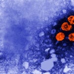 Experimental hepatitis B drug may offer 'functional cure' for some patients