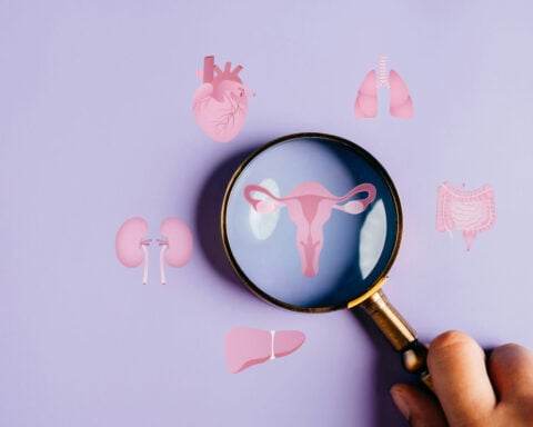 I’m a doctor who helped rename PCOS to PMOS – a 10-year process of listening to 14,000 patients and health professionals speak on how to improve care