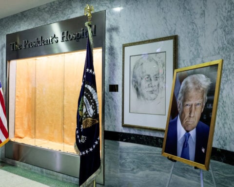 Trump in excellent health with leg swelling, hand bruising, doctor says