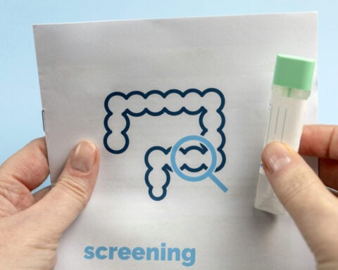 Poop tests and blood tests join colonoscopy as options for colorectal cancer screening