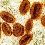 2 scientists charged with bringing deactivated mpox virus into the US and lying to authorities