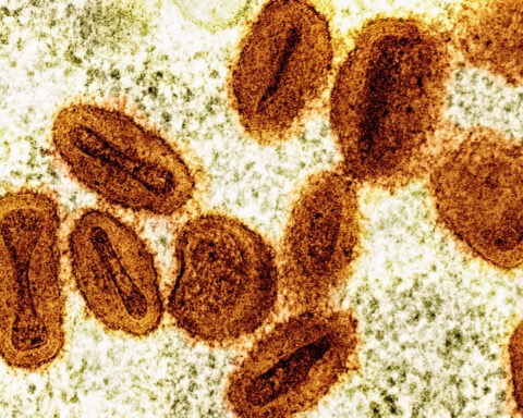 2 scientists charged with bringing deactivated mpox virus into the US and lying to authorities