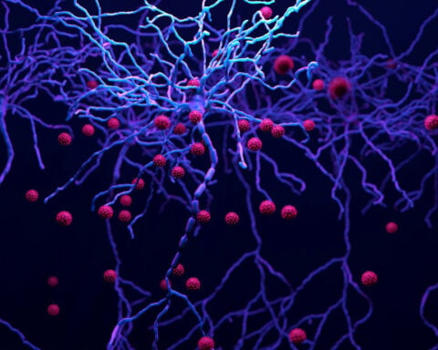 HIV enters the brain and doesn’t leave – paradoxically, drugs intended to reduce brain inflammation increase virus levels