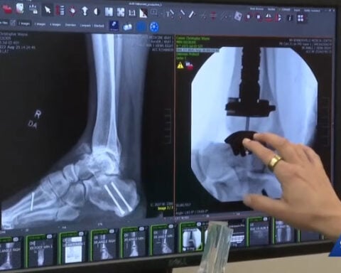 North Carolina grandfather has ankle totally replaced so he can walk with his grandson