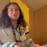 Summer camp gives young burn survivors room to heal, be kids